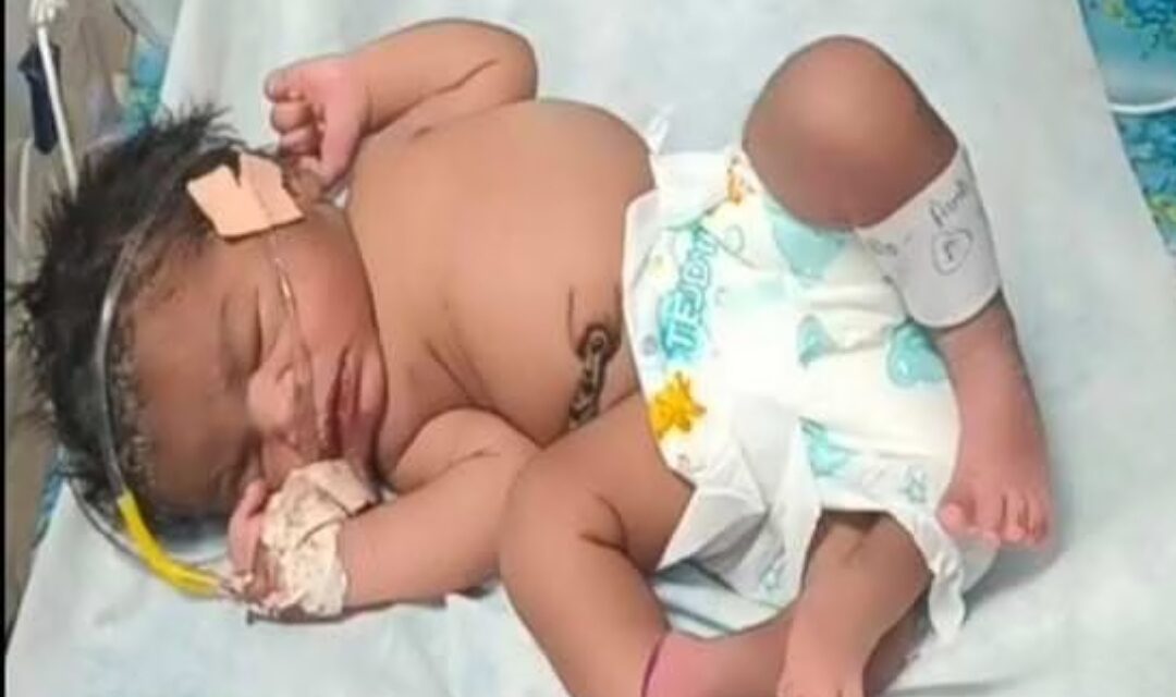 viral news: 4 ಕಾಲಿನ ಮಗುವಿಗೆ ಜನ್ಮ ನೀಡಿದ ಮಧ್ಯಪ್ರದೇಶದ ಮಹಿಳೆ